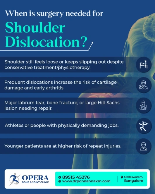 When is Surgery Needed for Shoulder Dislocation?