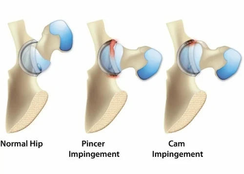 Breast reduction surgery in Thane