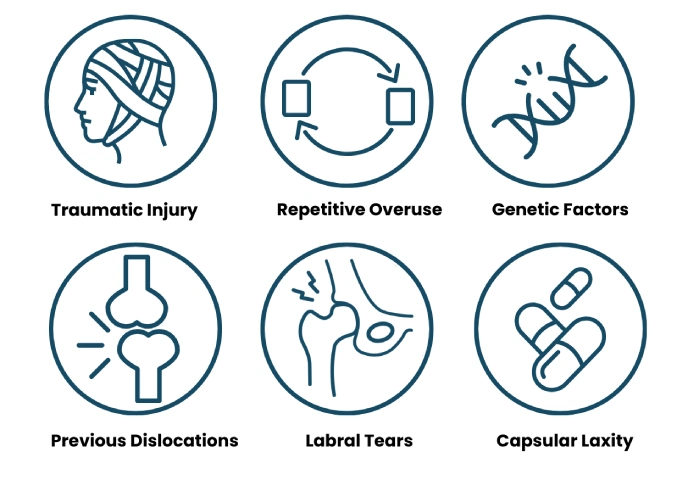 Causes of Shoulder Instability