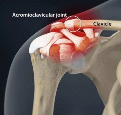 acromioclavicular joint