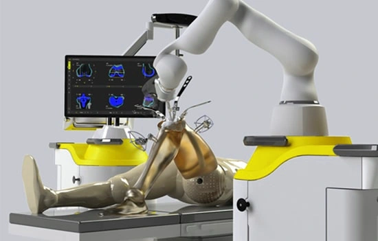 Robotic total knee replacement surgery