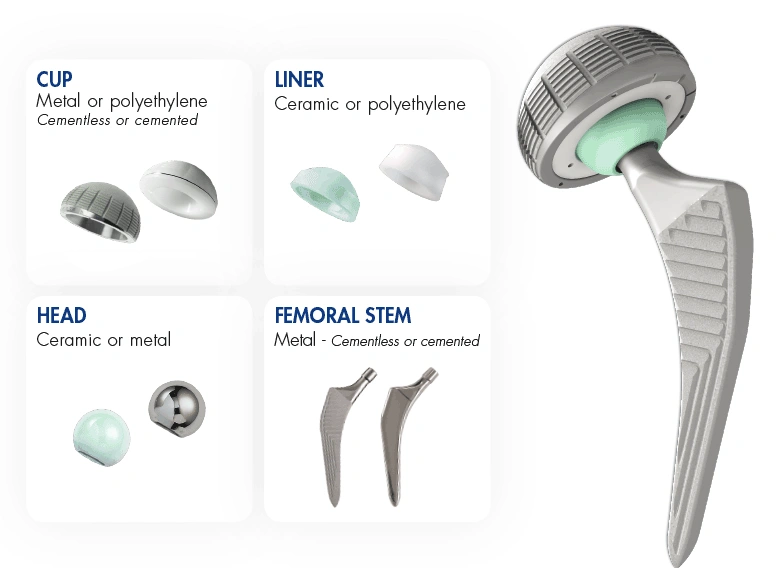 Type of metal