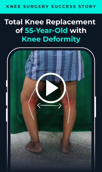 Knee Surgery Success Story