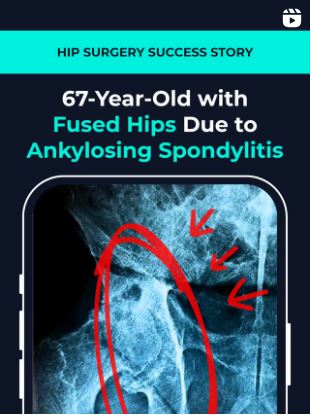 Hip Surgery Success Story