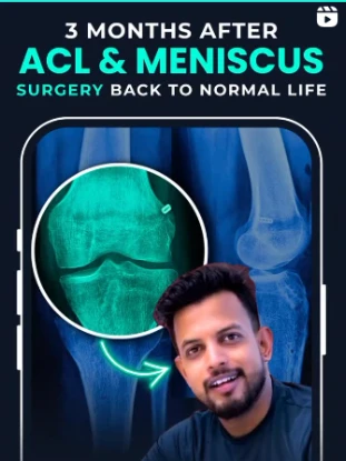 3 Months After ACL & Meniscus Surgery back to normal life