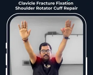 2 Shoulder Surgeries 100% Recovery – Success Story