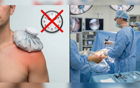 Frozen Shoulder Myths Frozen Shoulder Myths