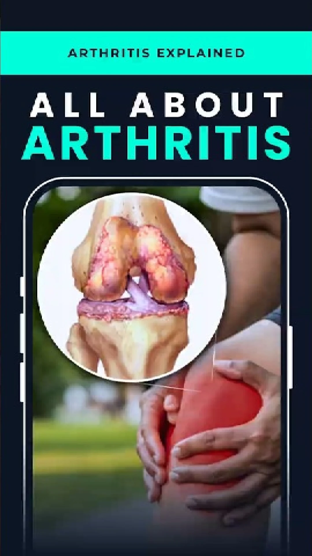 Knee Pain After 50? Understand Arthritis & When to Seek Help